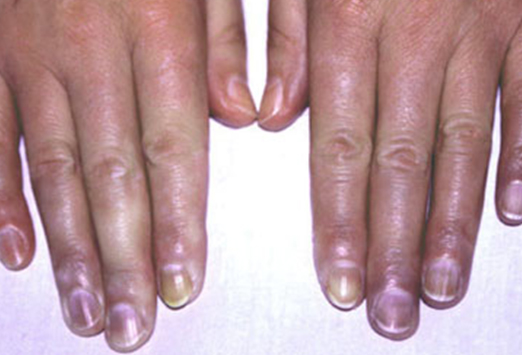 ���������� ������� �����