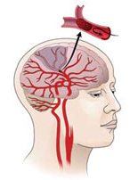 ����������� �������